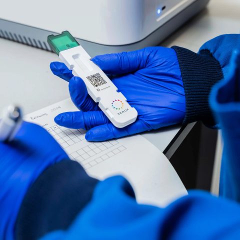 Clinician in blue gloves holding a Serox test cartridge